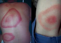 Описание: http://www.krasotaimedicina.ru/upload/iblock/812/812ad7c564c3861f3ea7da468393f325.jpg
